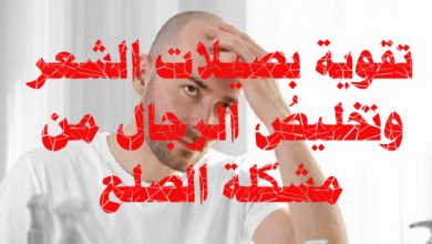 أسهل وسيلة "رخيصة" للتخلّص من الصلع