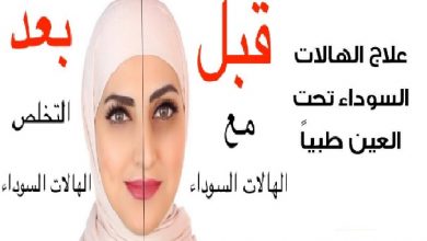 علاج الهالات السوداء حول العين