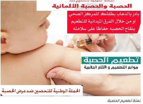 موعد تطعيم الحصبة للاطفال بالغربية