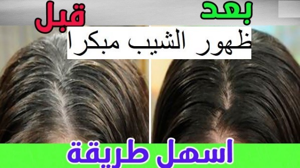 نصائح لتأخير ظهور الشعر الأبيض