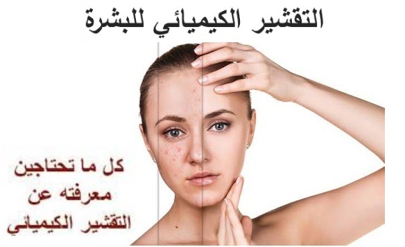 عيوب عملية التقشير الكيميائي