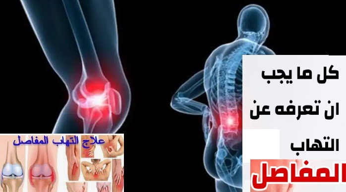 أطعمة تعالج على آلام المفاصل